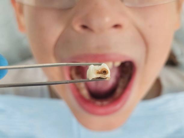 Best Tooth Pain Emergency Relief  in Random Lake, WI